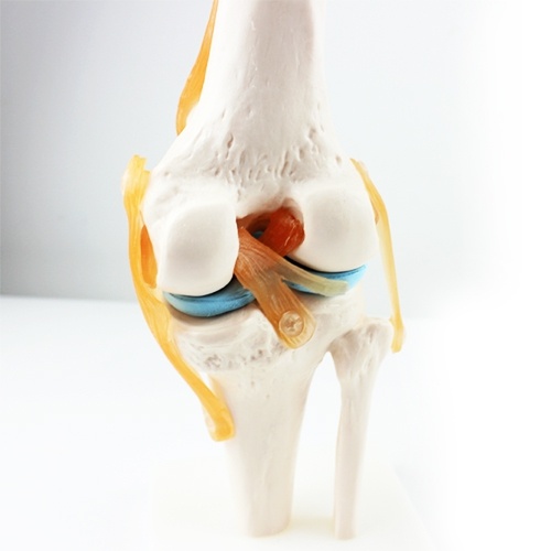 인체 무릎관절 모형