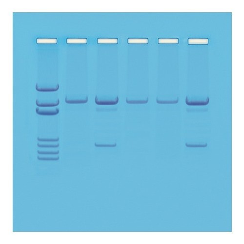 유전자 변형 생물 진단실험