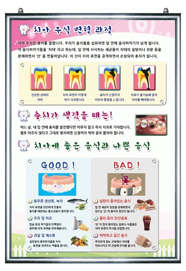 치아우식변형과정