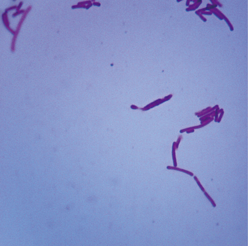유산균 프레파라트 / 락토바실러균 USA